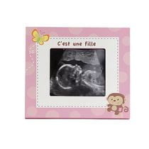Kangaroo Baby Sonogram/Ultrasound Photo Frame - Pink - French Version