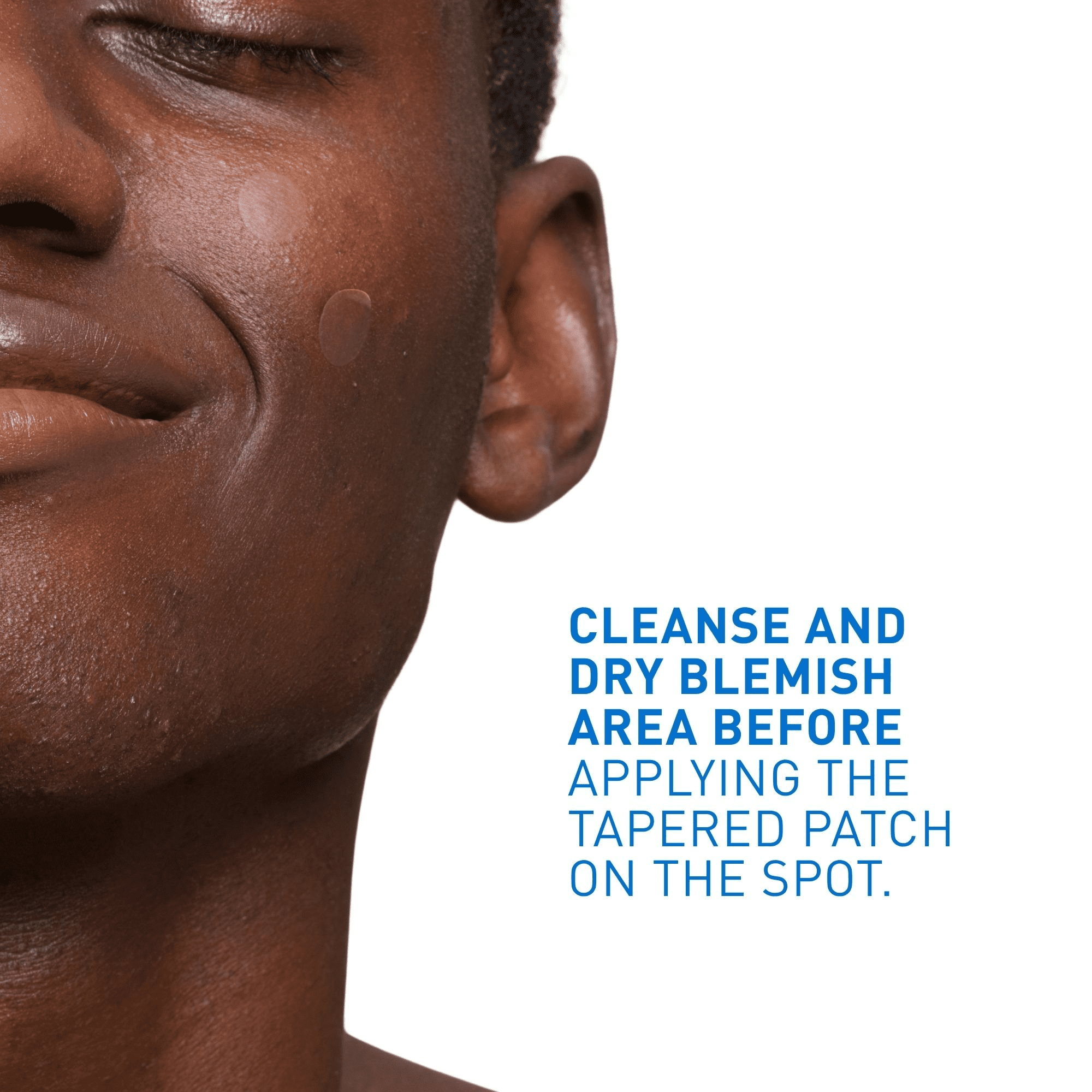 CeraVe Timbres Anti-Spot Barrière, Pansements Hydrocolloïdes Invisibles avec Céramides et Niacinamide