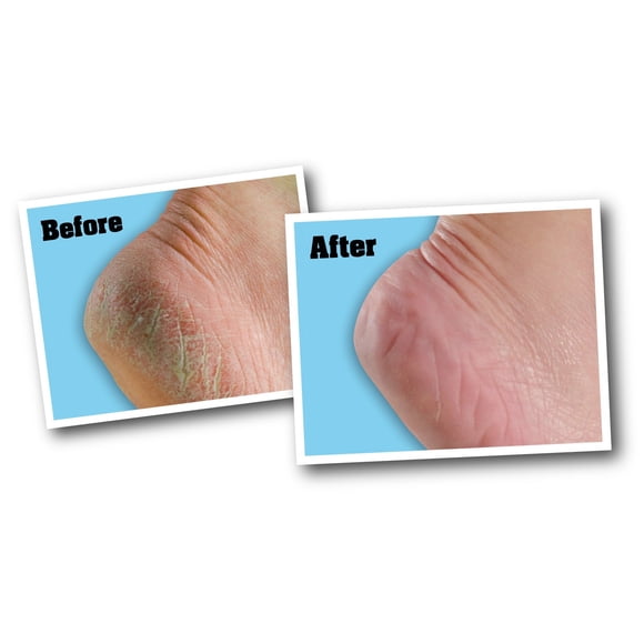 O'Keeffe's pour Healthy Feet Crème pour les Pieds - 3 Oz