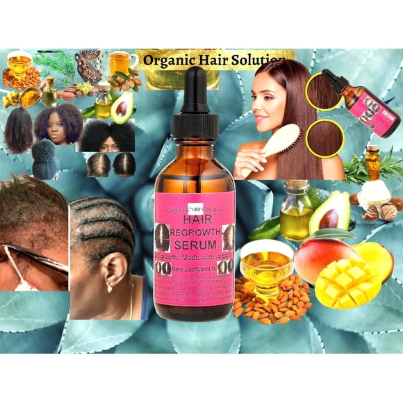 Solution Capillaire Biologique - Sérum de Croissance des Bords - Huile - Renforcement du Cuir Chevelu et des Cheveux - pour des Cheveux Plus Forts, Plus Épais et Plus Longs - pour Pointes Fourchues et Cuir Chevelu Sec - Menthe Poivrée - Avocat - Ricin - Arbre à Thé - (2oz