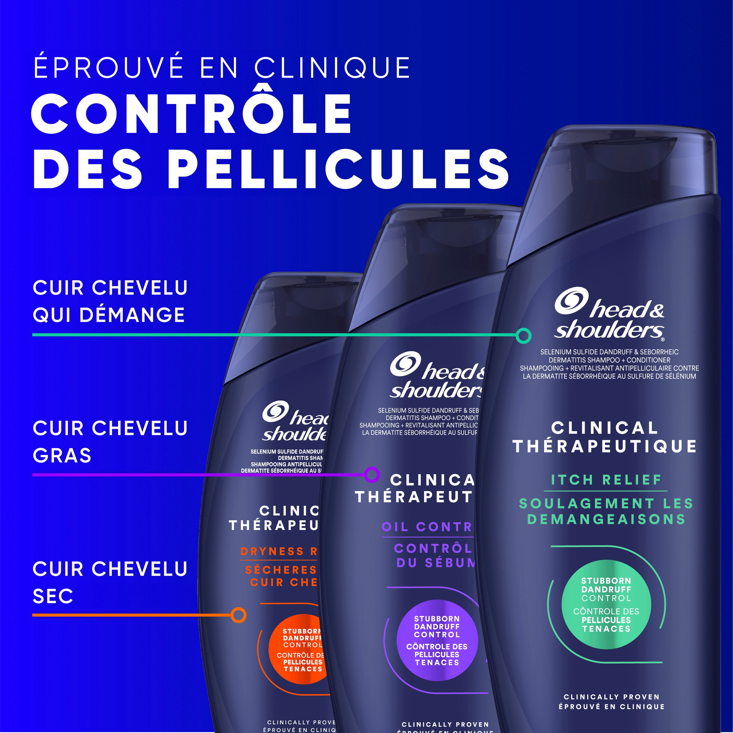 Head & Shoulders Dandruff Shampoo, Clinical Strength Oil Control, 1% Selenium Sulfide, Oily Scalp, Flake Protection, Stubborn Dandruff Control, Jasmine Scent, 400 mL