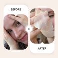 thumbnail image 2 of Maskeraide, Hydrocolloid Nose Patches, Nose strips, Pore strips, Spotted Pores, 2 of 5