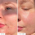 thumbnail image 4 of JIUOU REN Clean - Evercalm Barrier Support Anti-aging, 4 of 8