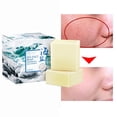 thumbnail image 2 of EIMELI Sea Sulfur Soap Bar by - Natural Face and Body Treatment Soap with Sulphur and Minerals from Sea Quickly Remove Mites Repair Nourish Skin, 2 of 12