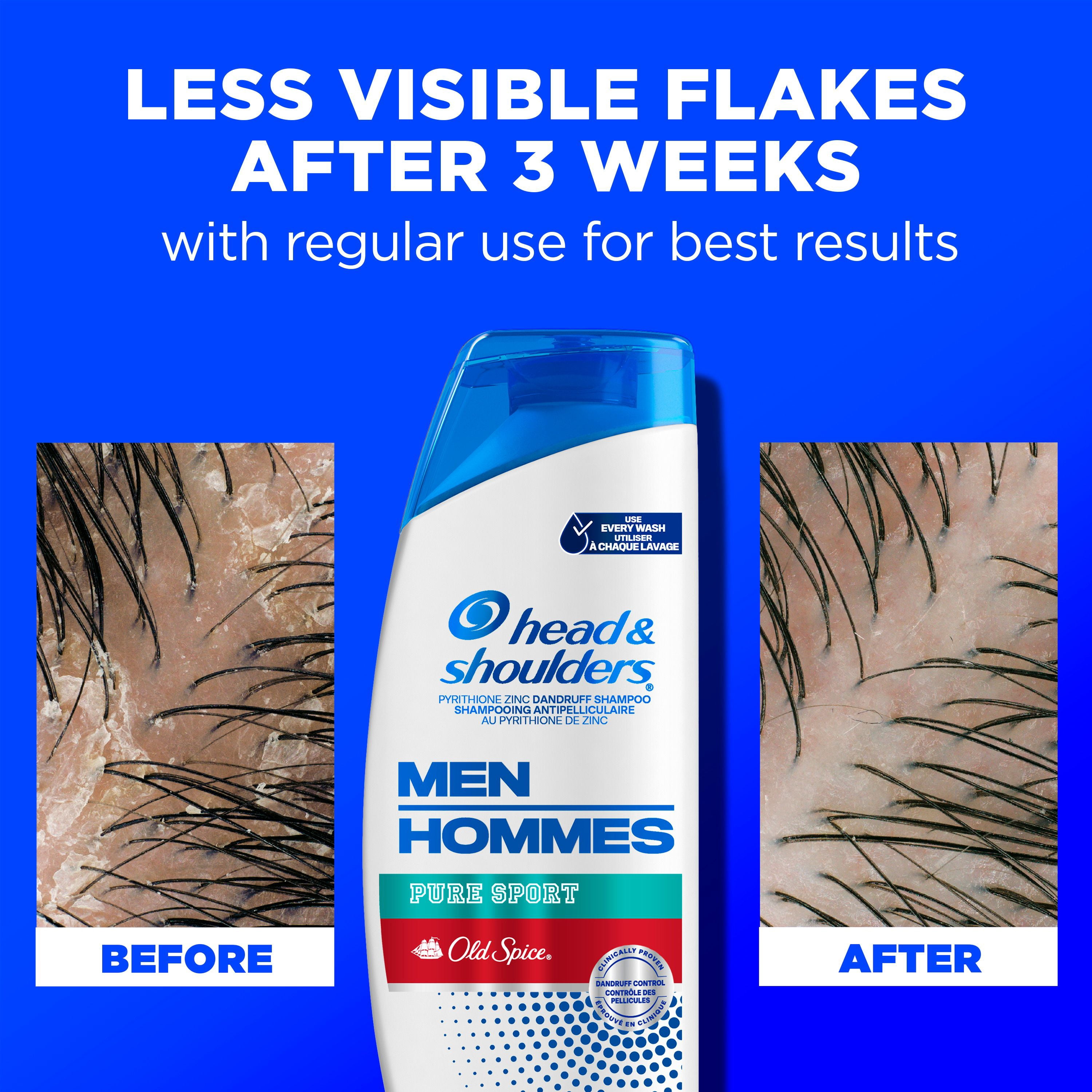Head & Shoulders Old Spice Pure Sport Shampooing Antipelliculaire pour Hommes