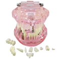 thumbnail image 4 of Dentalmall Teeth Model Teeth Typodonts Dental Implant Study Analysis Demonstration Teeth Model #2001 with Restoration Pink, 4 of 4