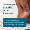 thumbnail image 2 of AmLactin Foot Repair Foot Cream Therapy 3 oz + One Pair Moisturizing Heel Socks, 2 of 5