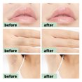 thumbnail image 3 of SUMAX Body Wax Strips Portable Double-Sided Hair Removal Paper for Lips/Arms/Legs/Underarm Hair, 3 of 5