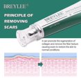 thumbnail image 5 of Breylee Crème pour Enlever les Cicatrices d'Acné: 30 g, Réparation de la Peau (1 Pcs), 5 of 5