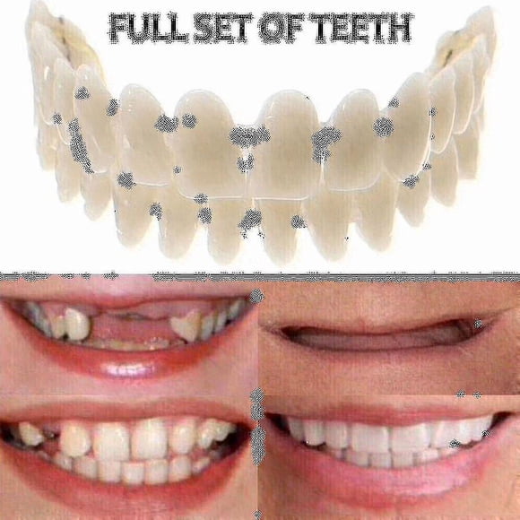 Smile Snap On Upperbottom Dental False Teeth Tooth Denture Cover Set Veneers