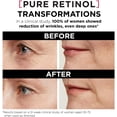 thumbnail image 4 of L’Oreal Paris Retinol Serum for Face, 30 mL, 4 of 9