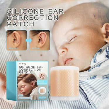 DPTALR Ruban Correcteur d'Oreille Doux et Respirant pour Bébé, Patch de Correction de l'Auricule et du Valgus pour Enfant Nourrisson, Outils de Soins des Oreilles pour Bébé