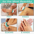 thumbnail image 4 of Skoother Skin Smoother Foot File and Callus Remover, 4 of 5