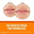 thumbnail image 4 of O'Keeffe's Unscented Lip Repair Lip Balm for Dry, Cracked Lips, Stick, 4 of 5