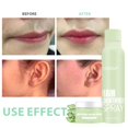 thumbnail image 4 of 1pc Hair identifier Spray for Face Shaving, Skin Body Hair Identifying Spray With Razors,Hair identifier Spray for Face Dermaplaning, Women Dermaplaning Tool for Face, 4 of 7