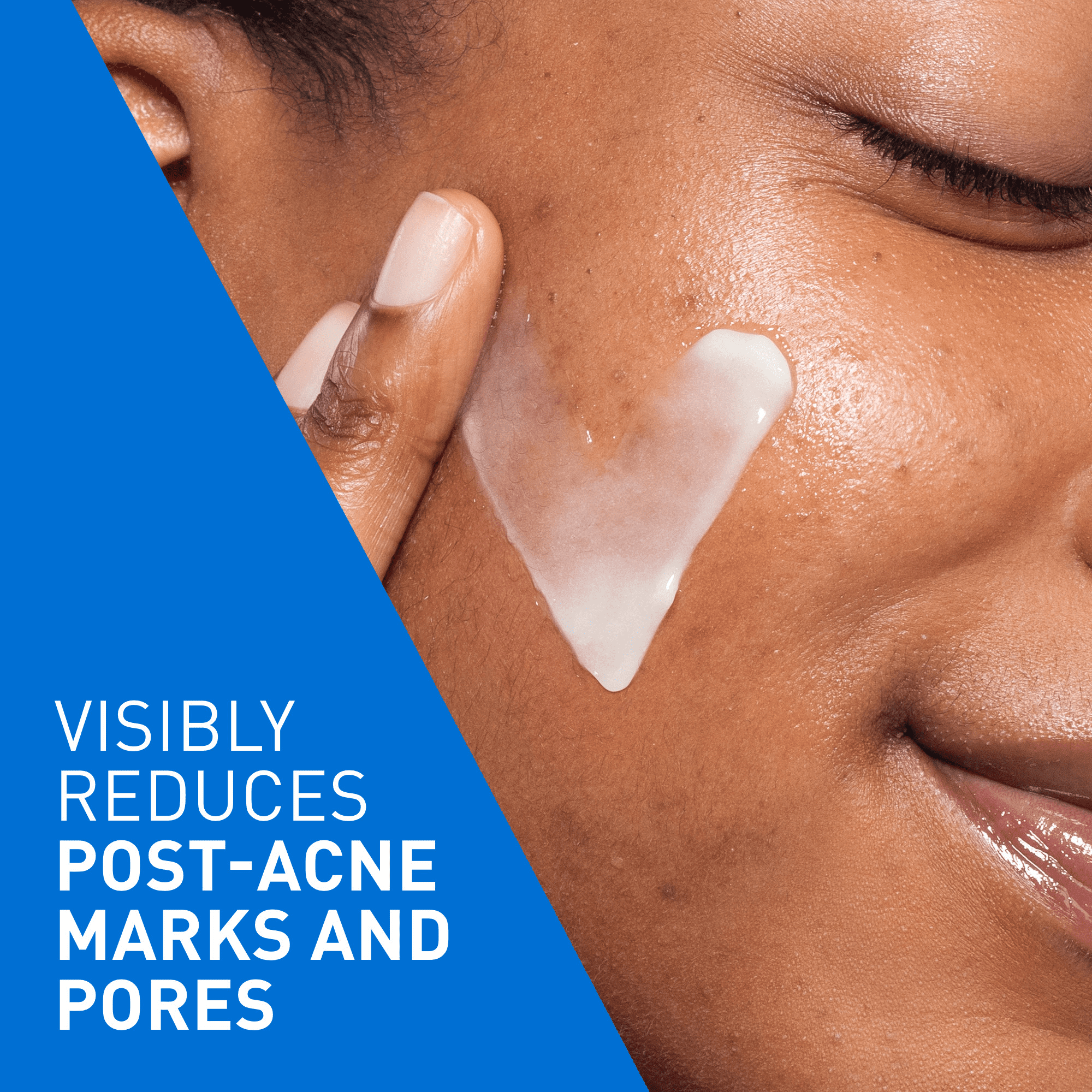 CeraVe Sérum Rénovateur au Rétinol, Sérum Visage avec Rétinol Encapsulé pour Marques Post-Acné, 30 ml