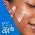 thumbnail image 3 of CeraVe Resurfacing Retinol Serum, Face Serum with Encapsulated Retinol and Ceramides for Post-Acne Marks, 30mL, 3 of 14