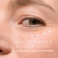 thumbnail image 2 of RoC Skincare - Retinol Correxion®️ - Line Smoothing Eye Cream (15ml), 2 of 12