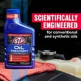 thumbnail image 3 of STP Oil Treatment (400 mL), CA, 3 of 9
