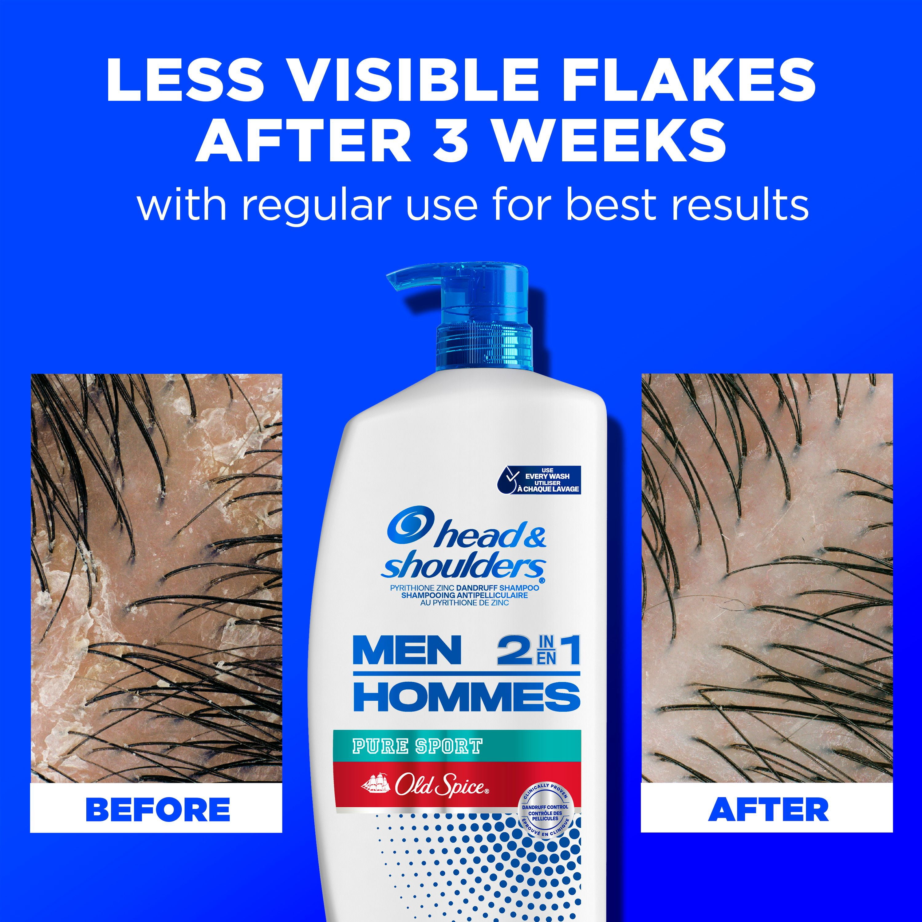 Head & Shoulders Old Spice Pure Sport 2-in-1 Anti-Dandruff Shampoo + Conditioner for Men
