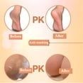 thumbnail image 3 of Gel Silicone Heel Dry Socks Unisex Moisturizing Protectors Foot Skin Socks, 3 of 9