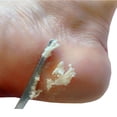 thumbnail image 1 of pitrice Racleur de Pied en Acier Inoxydable Callus Détachant Fichier Professionnel Portable Salon Pédicure Manucure Exfoliant Outils Pieds Soins Type 1, 1 of 8