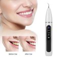 thumbnail image 2 of Scaler  Plaque Remover Teeth Stain Remover Intelligent  Electric  Scaler  Calculus Plaque Tartar Remover Cleaner, 2 of 8