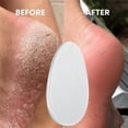 thumbnail image 3 of RKSTN Foots File Foot File Glass Foot File Callus Remover Glass Foot File For Heel Shower Foot Dead Skin Remover, 3 of 8