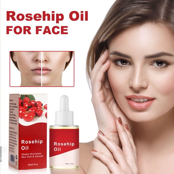 Rosehip Oil for Face, Pure Organic Rosehip Seed Oil Cold Pressed Moisturizer for Hair, Skin & Nails