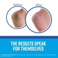 thumbnail image 5 of O'Keeffe's Healthy Feet Exfoliating Foot Cream 3 oz. Tube - 4 Pack, 5 of 5