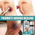thumbnail image 3 of Medical Glue For Cuts, Fast-drying & Breathable Liquid Skin Bandage, Great For Use On Fingers, 3 of 5