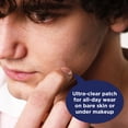 thumbnail image 3 of PanOxyl Daytime Invisible Patches, Blemish Coverage, Latex-Free, 3 of 13