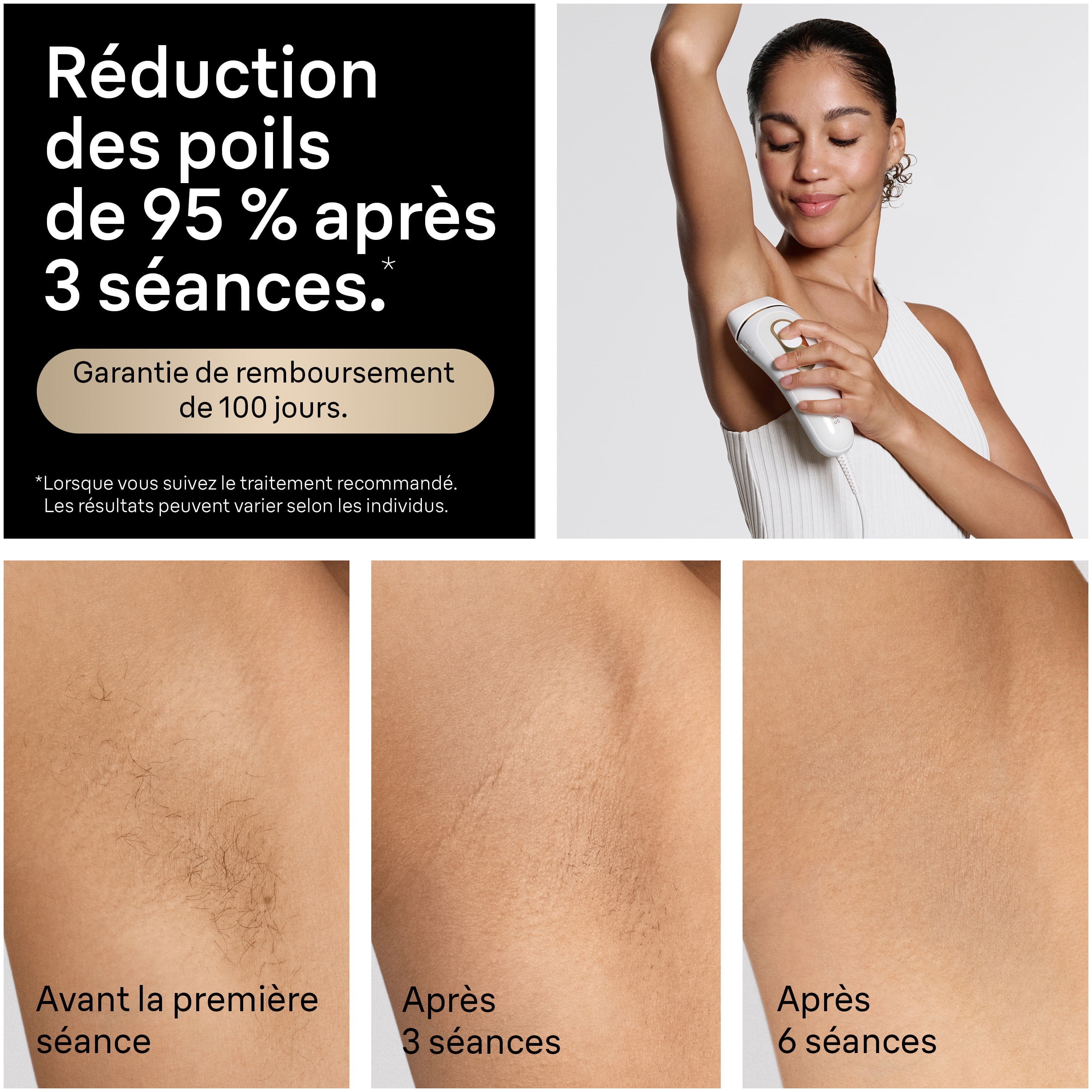 Braun Silk-Expert Pro 5 IPL PL5157 Épilation au Laser à Domicile pour Femmes et Hommes avec Étui de Qualité Supérieure, 2 Têtes, Rasoir Venus