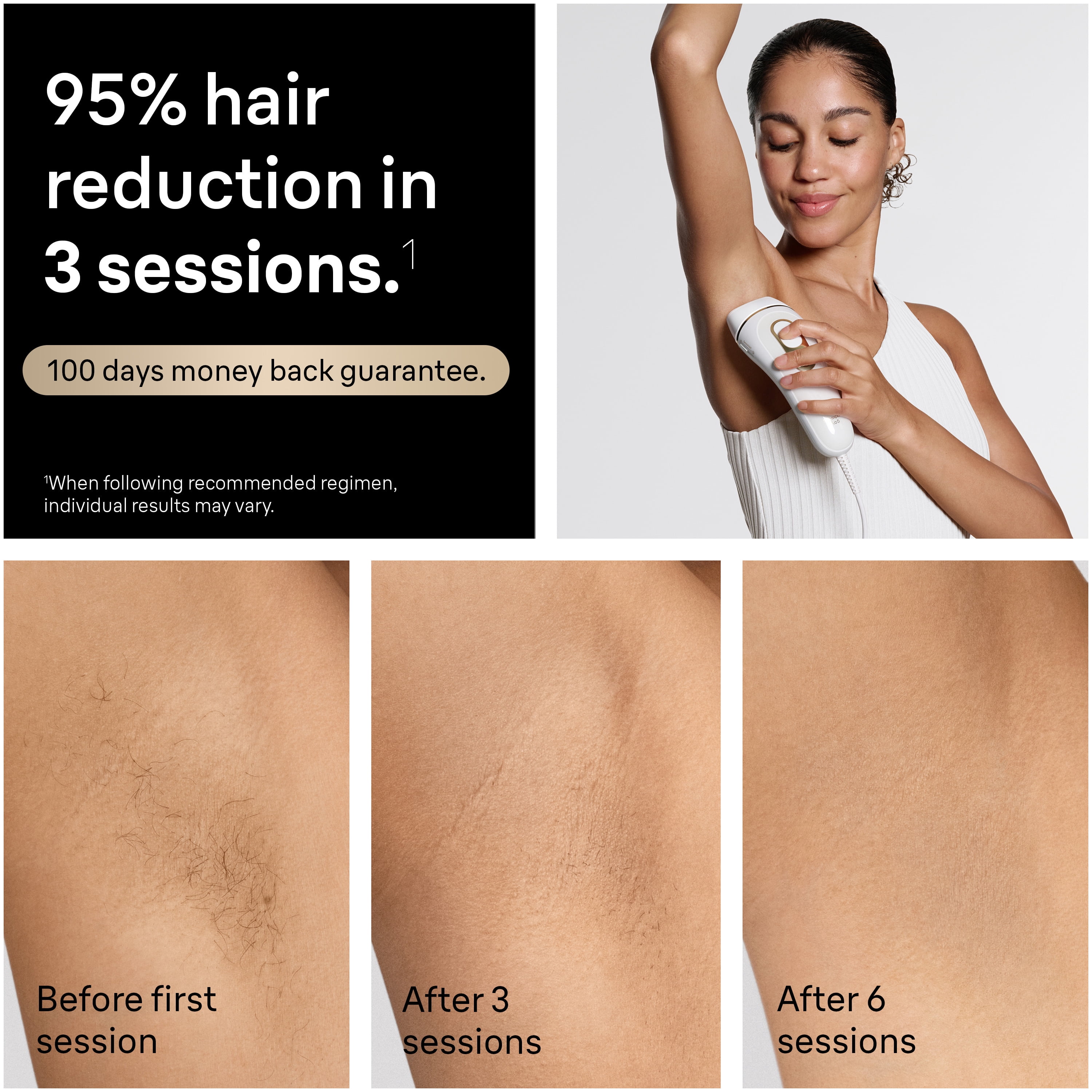 Braun Silk-Expert Pro 5 IPL PL5157 Épilation au Laser à Domicile pour Femmes et Hommes avec Étui de Qualité Supérieure, 2 Têtes, Rasoir Venus