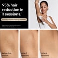 thumbnail image 3 of Braun Silk-Expert Pro 5 IPL PL5157 at Home Laser Hair Removal for Women and Men with Premium Pouch, 2 Heads, Venus Razor, 3 of 13