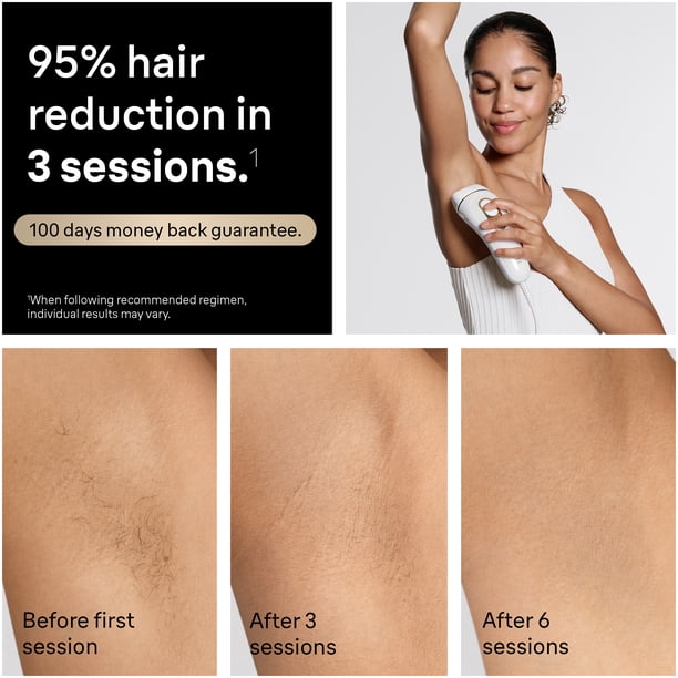 Braun Silk-Expert Pro 5 IPL PL5157 at Home Laser Hair Removal for