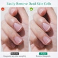 thumbnail image 3 of Nail 2 Stainless Steel Cuticle Trimmer Dead Skin Remover Tool for Manicure Pedicure Grooming Kit, 3 of 6