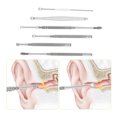 thumbnail image 3 of Amdohai Stainless Steel Ear Pick Set Curette Ear Wax Remover Spiral Spring Earpick Ear Cleaner, 3 of 4