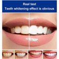 thumbnail image 3 of XINQIHANG Yayashi Sp-4 Toothpaste,Yiliku Sp-4 Whitening Toothpaste,3D White Toothpaste,Whitening Toothpaste for Adults,Tooth Polishing Paste-Tooth Stain Remover, Fresh Breath (2PACK,A), 3 of 7