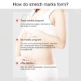 thumbnail image 5 of DYD Huile pour Marques d'Étirement Post-Partum 121 ml Naturelle pour les Ridules de Grossesse Huile Raffermissante pour le Corps pour Nouvelles Mamans, 5 of 5