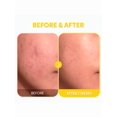 thumbnail image 2 of TIRTIR Pure Vitamin C 24 Serum 30ml, 2 of 5