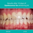 thumbnail image 2 of Opalescence Go - Prefilled Teeth Whitening Trays - 15% Hydrogen Peroxide - Mint, 2 of 9