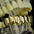 thumbnail image 3 of CNKOO 14k Gold Plated Fang Grillz Eight Tooth Bottom 8 Teeth Hip Hop Mens Fangs Vampire Grills, 3 of 3