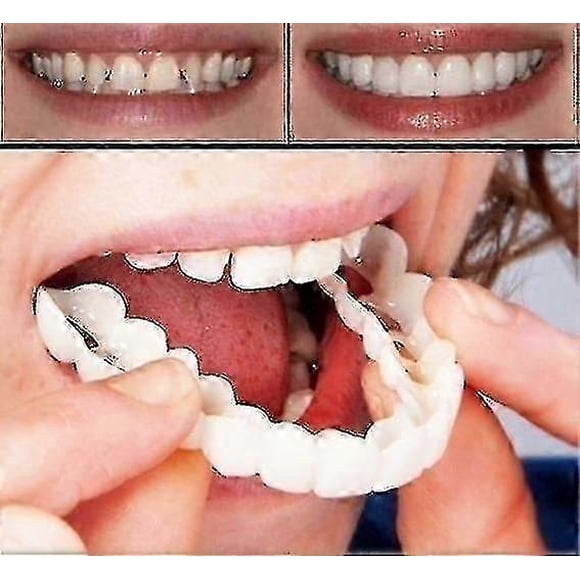 A Pair Upper & Lower Denture Instant Smile Comfort Fit Flex Cosmetic Teeth Denture Teeth Top Cosmetic Veneer