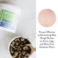 thumbnail image 5 of KP Elements Keratosis Pilaris Lotion (4 fl oz) - Natural Keratosis Pilaris Treatment Moisturizing & Exfoliating AHA Lotion for KP Vegan Made in USA, 5 of 5