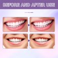 thumbnail image 3 of Tooth Jewelry Glues Teeth Decorations Gel Light Cure Flowable Jewelry Composite Tooth Tools M Professional Gem Adhesive X5R9, 3 of 5