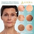 thumbnail image 4 of ABERA Melas Anti Dark Spot Serum, 4 of 7