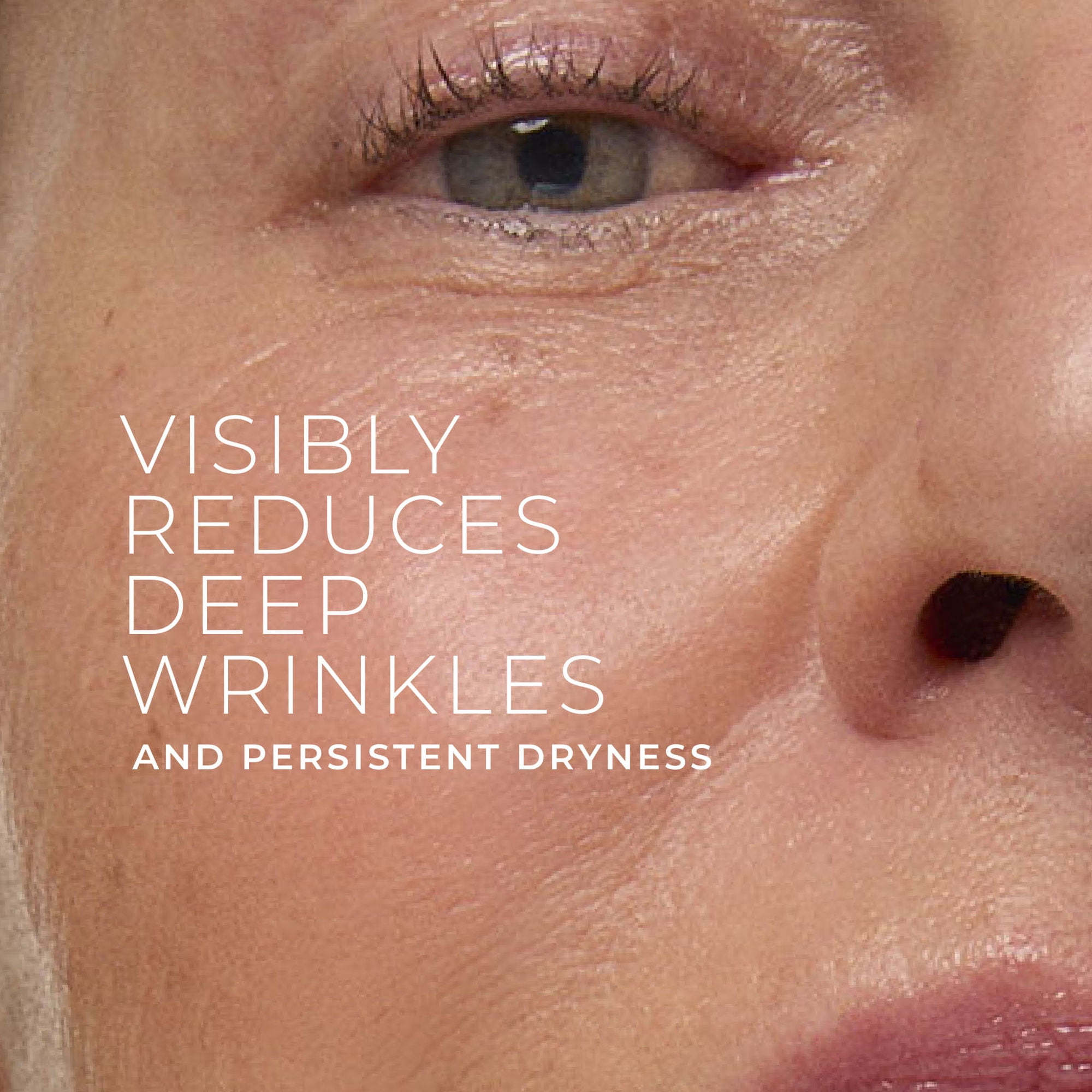 RoC Soins de la Peau - Retinol Correxion® Crème Riche Anti-Rides Profondes