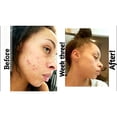 thumbnail image 2 of The Ordinary Retinol 1% in Squalane 1-Pack, 2 of 3