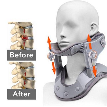 POINTERTECK Cervical Traction Device Adjustable Ergonomic Heat Treatment Electric Comfortable Pain Relief Portable Heating Neck Tractor Stretcher Posture Corrector for Home